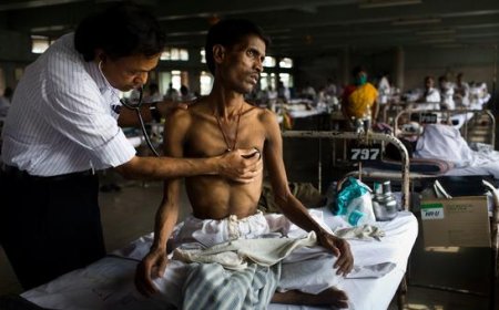 TB cases fall for first time since pandemic