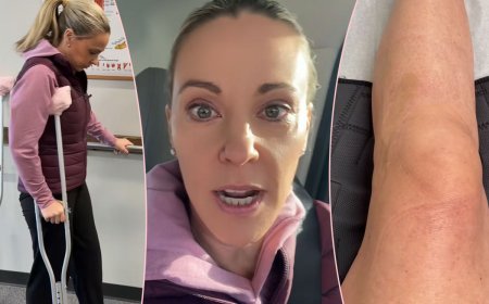 Kate Gosselin Shares Update Months After ‘Life-Altering’ Leg Injury Left Her Unable To Walk!