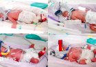 Rare identical quadruplets born in Australia