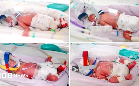 Rare identical quadruplets born in Australia