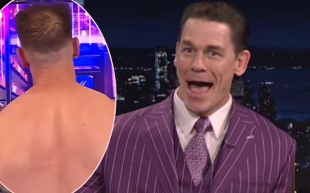 John Cena Reveals Update After Undergoing 2 Hair Transplants!