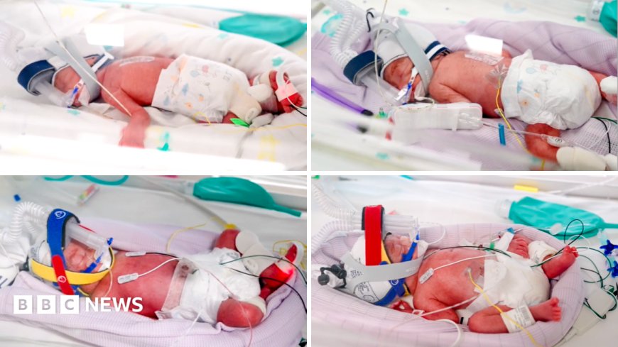 Rare identical quadruplets born in Australia